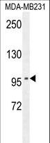 ST7 Antibody - ST7 Antibody western blot of MDA-MB231 cell line lysates (35 ug/lane). The ST7 antibody detected the ST7 protein (arrow).