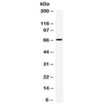 ST7 Antibody - Western blot testing of human PANC cell lysate with ST7 antibody at 0.5ug/ml. Predicted molecular weight ~67 kDa.