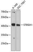ST8SIA1 Antibody - Western blot analysis of extracts of various cell lines using ST8SIA1 Polyclonal Antibody at dilution of 1:3000.