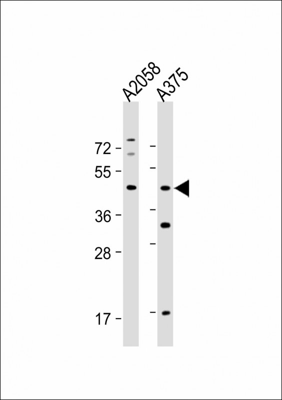 ST8SIA1 Antibody - All lanes: Anti-ST8SIA1 Antibody (N-Term) at 1:1000-1:2000 dilution Lane 1: A2058 whole cell lysate Lane 2: A375 whole cell lysate Lysates/proteins at 20 µg per lane. Secondary Goat Anti-Rabbit IgG, (H+L), Peroxidase conjugated at 1/10000 dilution. Predicted band size: 41 kDa Blocking/Dilution buffer: 5% NFDM/TBST.