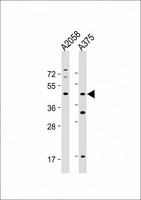 ST8SIA1 Antibody - All lanes: Anti-ST8SIA1 Antibody (N-Term) at 1:1000-1:2000 dilution Lane 1: A2058 whole cell lysate Lane 2: A375 whole cell lysate Lysates/proteins at 20 µg per lane. Secondary Goat Anti-Rabbit IgG, (H+L), Peroxidase conjugated at 1/10000 dilution. Predicted band size: 41 kDa Blocking/Dilution buffer: 5% NFDM/TBST.