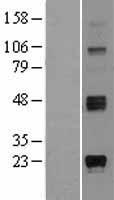 ST8SIA1 Protein - Western validation with an anti-DDK antibody * L: Control HEK293 lysate R: Over-expression lysate