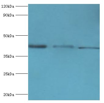 ST8SIA2 / STX Antibody - Western blot. All lanes: Alpha-2,8-sialyltransferase 8B antibody at 8 ug/ml. Lane 1: mouse heart tissue. Lane 2: HepG2 whole cell lysate. Lane 3: mouse kidney tissue. secondary Goat polyclonal to rabbit at 1:10000 dilution. Predicted band size: 42 kDa. Observed band size: 42 kDa.