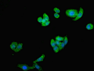 ST8SIA2 / STX Antibody - Immunofluorescent analysis of HepG2 cells using ST8SIA2 Antibody at dilution of 1:100 and Alexa Fluor 488-congugated AffiniPure Goat Anti-Rabbit IgG(H+L)