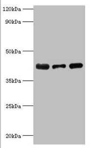 ST8SIA2 / STX Antibody - Western blot All lanes: Alpha-2, 8-sialyltransferase 8B antibody at 8µg/ml Lane 1: Mouse heart tissue Lane 2: HepG2 whole cell lysate Lane 3: Mouse kidney tissue Secondary Goat polyclonal to rabbit IgG at 1/10000 dilution Predicted band size: 42 kDa Observed band size: 42 kDa