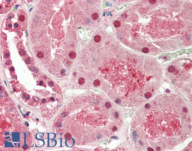 ST8SIA2 / STX Antibody - Anti-ST8SIA2 / STX antibody IHC staining of human kidney. Immunohistochemistry of formalin-fixed, paraffin-embedded tissue after heat-induced antigen retrieval. Antibody concentration 5 ug/ml.  This image was taken for the unconjugated form of this product. Other forms have not been tested.