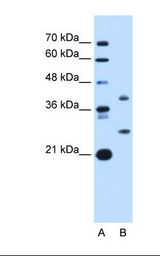 ST8SIA2 / STX Antibody - Lane A: Marker. Lane B: HepG2 cell lysate. Antibody concentration: 1.0 ug/ml. Gel concentration: 12%.  This image was taken for the unconjugated form of this product. Other forms have not been tested.