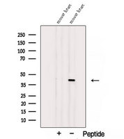 ST8SIA2 / STX Antibody - Western blot analysis of extracts of mouse heart tissue using ST8SIA2-Specific antibody. The lane on the left was treated with blocking peptide.