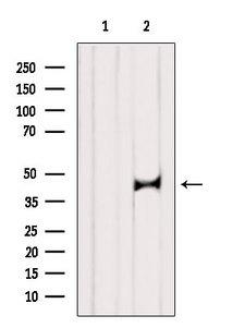 ST8SIA2 / STX Antibody