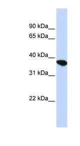 ST8SIA4 Antibody - ST8SIA4 antibody Western blot of HepG2 cell lysate. This image was taken for the unconjugated form of this product. Other forms have not been tested.