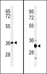 ST8SIA4 Antibody - Western blot of ST8SIA4 Antibody in HL-60 cell line lysates (35 ug/lane). ST8SIA4 (arrow) was detected using the purified antibody. Western blot of ST8SIA4 Antibody in mouse spleen tissue lysates (35 ug/lane). ST8SIA4 (arrow) was detected using the purified antibody.