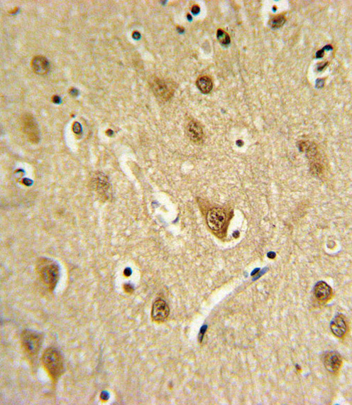 ST8SIA4 Antibody - ST8SIA4 Antibody IHC of formalin-fixed and paraffin-embedded brain tissue followed by peroxidase-conjugated secondary antibody and DAB staining.
