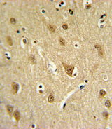 ST8SIA4 Antibody - ST8SIA4 Antibody IHC of formalin-fixed and paraffin-embedded brain tissue followed by peroxidase-conjugated secondary antibody and DAB staining.