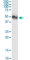 ST8SIA4 Antibody - ST8SIA4 monoclonal antibody (M03), clone 1H5. Western Blot analysis of ST8SIA4 expression in human kidney.