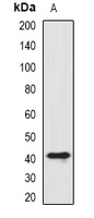 ST8SIA4 Antibody - Western blot analysis of SIAT8D expression in HL60 (A) whole cell lysates.