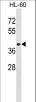 ST8SIA6 Antibody - ST8SIA6 Antibody western blot of HL-60 cell line lysates (35 ug/lane). The ST8SIA6 antibody detected the ST8SIA6 protein (arrow).