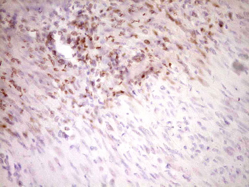 STAB2 / HARE Antibody - Immunohistochemical staining of paraffin-embedded Human endometrium tissue within the normal limits using anti-STAB2 mouse monoclonal antibody. (Heat-induced epitope retrieval by 1 mM EDTA in 10mM Tris, pH8.5, 120C for 3min,