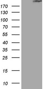 STAB2 / HARE Antibody - HEK293T cells were transfected with the pCMV6-ENTRY control. (Left lane) or pCMV6-ENTRY STAB2. (Right lane) cDNA for 48 hrs and lysed. Equivalent amounts of cell lysates. (5 ug per lane) were separated by SDS-PAGE and immunoblotted with anti-STAB2.