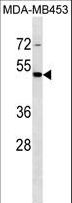 STAC Antibody - STAC Antibody western blot of MDA-MB453 cell line lysates (35 ug/lane). The STAC Antibody detected the STAC protein (arrow).