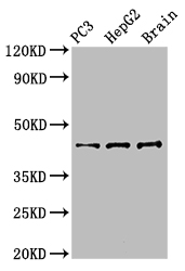 STAC Antibody - Western Blot Positive WB detected in: PC-3 whole cell lysate, HepG2 whole cell lysate All lanes: STAC antibody at 3µg/ml Secondary Goat polyclonal to rabbit IgG at 1/50000 dilution Predicted band size: 45 kDa Observed band size: 45 kDa