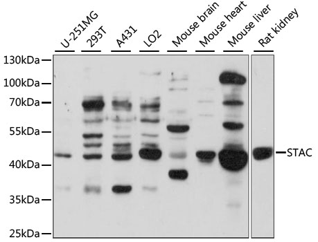 STAC Antibody - Western blot analysis of extracts of various cell lines, using STAC antibody at 1:1000 dilution. The secondary antibody used was an HRP Goat Anti-Rabbit IgG (H+L) at 1:10000 dilution. Lysates were loaded 25ug per lane and 3% nonfat dry milk in TBST was used for blocking. An ECL Kit was used for detection and the exposure time was 90s.