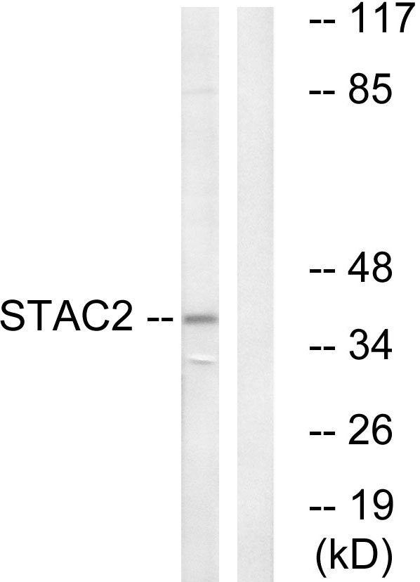STAC2 Antibody - Western blot analysis of lysates from K562 cells, using STAC2 Antibody. The lane on the right is blocked with the synthesized peptide.