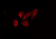 STAC2 Antibody - Staining HeLa cells by IF/ICC. The samples were fixed with PFA and permeabilized in 0.1% Triton X-100, then blocked in 10% serum for 45 min at 25°C. The primary antibody was diluted at 1:200 and incubated with the sample for 1 hour at 37°C. An Alexa Fluor 594 conjugated goat anti-rabbit IgG (H+L) Ab, diluted at 1/600, was used as the secondary antibody.