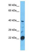 STAC3 Antibody - STAC3 antibody Western Blot of HepG2. Antibody dilution: 1 ug/ml.  This image was taken for the unconjugated form of this product. Other forms have not been tested.