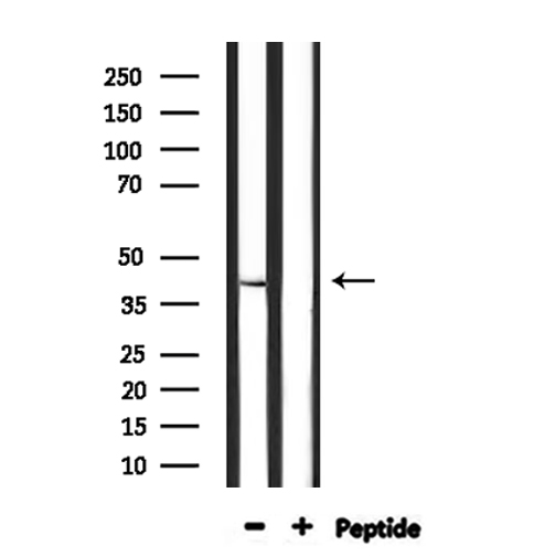 STAC3 Antibody - Western blot analysis of extracts of various samples using STAC3 antibody. Lane 1: 293 treated with blocking peptide. Lane 2: 293; Lane 3: HuvEc;