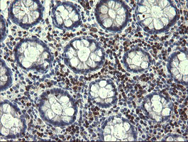 STAF50 / TRIM22 Antibody - IHC of paraffin-embedded Human colon tissue using anti-TRIM22 mouse monoclonal antibody. (Heat-induced epitope retrieval by 10mM citric buffer, pH6.0, 120°C for 3min).