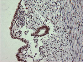 STAF50 / TRIM22 Antibody - IHC of paraffin-embedded Human endometrium tissue using anti-TRIM22 mouse monoclonal antibody. (Heat-induced epitope retrieval by 10mM citric buffer, pH6.0, 120°C for 3min).