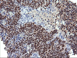 STAF50 / TRIM22 Antibody - IHC of paraffin-embedded Human tonsil using anti-TRIM22 mouse monoclonal antibody. (Heat-induced epitope retrieval by 10mM citric buffer, pH6.0, 120°C for 3min).