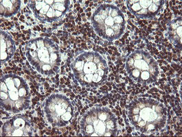 STAF50 / TRIM22 Antibody - IHC of paraffin-embedded Human colon tissue using anti-TRIM22 mouse monoclonal antibody. (Heat-induced epitope retrieval by 10mM citric buffer, pH6.0, 120°C for 3min).