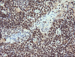 STAF50 / TRIM22 Antibody - IHC of paraffin-embedded Human tonsil using anti-TRIM22 mouse monoclonal antibody. (Heat-induced epitope retrieval by 10mM citric buffer, pH6.0, 120°C for 3min).