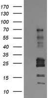 STAF50 / TRIM22 Antibody - E.coli lysate (5 ug, left lane) and E.coli lysate expressing human recombinant protein fragment (5 ug, right lane) corresponding to amino acids 61-406 of human TRIM22 (NP_006065) were separated by SDS-PAGE and immunoblotted with anti-TRIM22.
