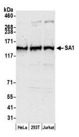 STAG1 / SA1 Antibody - Detection of human SA1 by western blot. Samples: Whole cell lysate (50 µg) from HeLa, 293T, and Jurkat cells prepared using NETN lysis buffer. Antibody: Affinity purified rabbit anti-SA1 antibody used for WB at 0.1 µg/ml. Detection: Chemiluminescence with an exposure time of 30 seconds.
