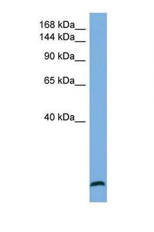 STAG1 / SA1 Antibody - Western blot of Human U937. STAG1 antibody dilution 1.0 ug/ml.  This image was taken for the unconjugated form of this product. Other forms have not been tested.