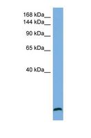 STAG1 / SA1 Antibody - Western blot of Human U937. STAG1 antibody dilution 1.0 ug/ml.  This image was taken for the unconjugated form of this product. Other forms have not been tested.