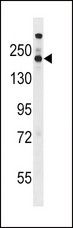 STAG1 / SA1 Antibody - STAG1 Antibody western blot of WiDr cell line lysates (35 ug/lane). The STAG1 antibody detected the STAG1 protein (arrow).