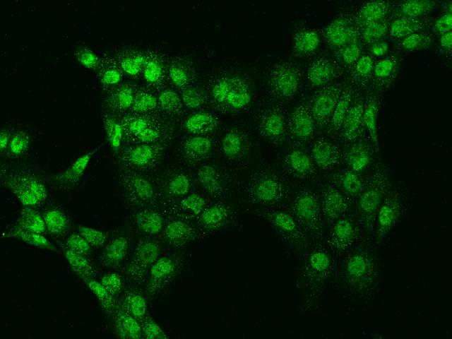 STAG1 / SA1 Antibody - Immunofluorescence staining of STAG1 in A431 cells. Cells were fixed with 4% PFA, permeabilzed with 0.1% Triton X-100 in PBS, blocked with 10% serum, and incubated with rabbit anti-Human STAG1 polyclonal antibody (dilution ratio 1:200) at 4°C overnight. Then cells were stained with the Alexa Fluor 488-conjugated Goat Anti-rabbit IgG secondary antibody (green). Positive staining was localized to Nucleus and Cytoplasm.