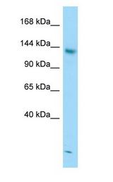 STAG2 Antibody - STAG2 antibody Western Blot of Jurkat.  This image was taken for the unconjugated form of this product. Other forms have not been tested.