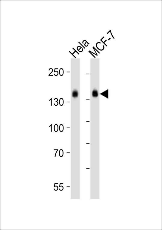 STAG2 Antibody - Western blot of lysates from HeLa, MCF-7 cell line (from left to right) with STAG2 Antibody. Antibody was diluted at 1:1000 at each lane. A goat anti-rabbit IgG H&L (HRP) at 1:10000 dilution was used as the secondary antibody. Lysates at 20 ug per lane.