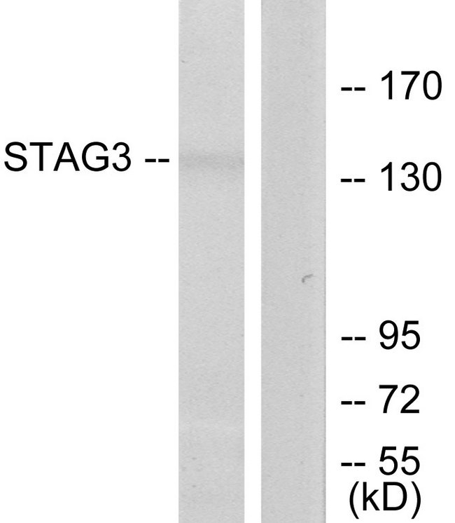 STAG3 Antibody - Western blot analysis of lysates from Jurkat cells, using STAG3 Antibody. The lane on the right is blocked with the synthesized peptide.