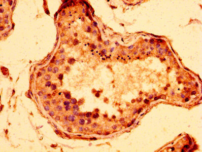 STAG3 Antibody - Immunohistochemistry image at a dilution of 1:300 and staining in paraffin-embedded human testis tissue performed on a Leica BondTM system. After dewaxing and hydration, antigen retrieval was mediated by high pressure in a citrate buffer (pH 6.0) . Section was blocked with 10% normal goat serum 30min at RT. Then primary antibody (1% BSA) was incubated at 4 °C overnight. The primary is detected by a biotinylated secondary antibody and visualized using an HRP conjugated SP system.