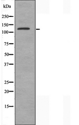 STAG3 Antibody - Western blot analysis of extracts of Jurkat cells using STAG3 antibody.