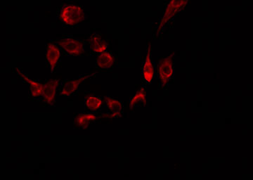 STAG3 Antibody - Staining HeLa cells by IF/ICC. The samples were fixed with PFA and permeabilized in 0.1% Triton X-100, then blocked in 10% serum for 45 min at 25°C. The primary antibody was diluted at 1:200 and incubated with the sample for 1 hour at 37°C. An Alexa Fluor 594 conjugated goat anti-rabbit IgG (H+L) Ab, diluted at 1/600, was used as the secondary antibody.