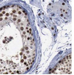 STAG3 Antibody - Immunohistochemistry of paraffin-embedded human testis tissue slide using STAG3 antibody at dilution of 1:200