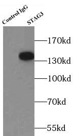 STAG3 Antibody - Result of anti-STAG3 (IP: anti-STAG3 antibody 4ug; Detection: anti-STAG3 antibody 1:300) with human testis tissue lysate 4000ug.