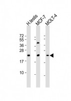 STAG3L1 Antibody - All lanes: Anti-STAG3L1 Antibody (Center) at 1:2000 dilution Lane 1: human testis lysate Lane 2: MCF-7 whole cell lysate Lane 3: MOLT-4 whole cell lysate Lysates/proteins at 20 µg per lane. Secondary Goat Anti-Rabbit IgG, (H+L), Peroxidase conjugated at 1/10000 dilution. Predicted band size: 24 kDa Blocking/Dilution buffer: 5% NFDM/TBST.