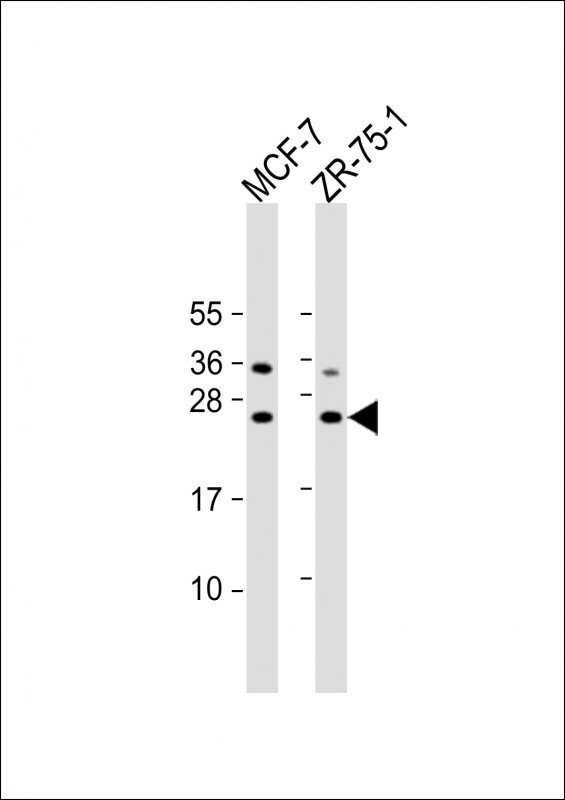 STAG3L1 Antibody - All lanes: Anti-STAG3L1 Antibody (Center) at 1:2000 dilution Lane 1: MCF-7 whole cell lysate Lane 2: ZR-75-1 whole cell lysate Lysates/proteins at 20 µg per lane. Secondary Goat Anti-Rabbit IgG, (H+L), Peroxidase conjugated at 1/10000 dilution. Predicted band size: 24 kDa Blocking/Dilution buffer: 5% NFDM/TBST.